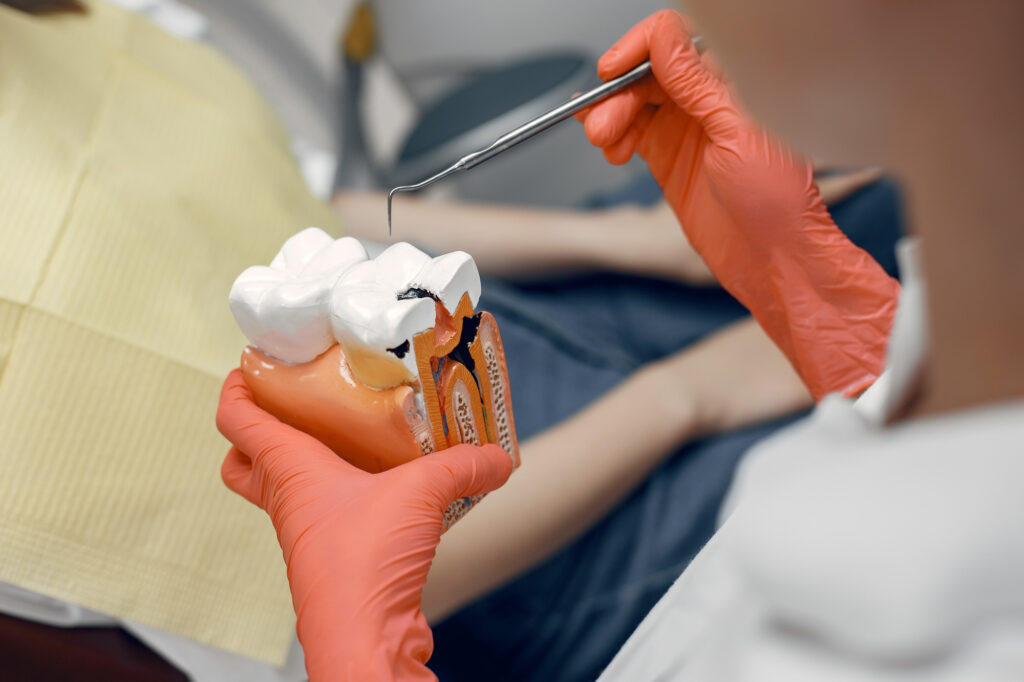A dental specialist holds a scale model of two teeth, with one tooth having a deep cavity.