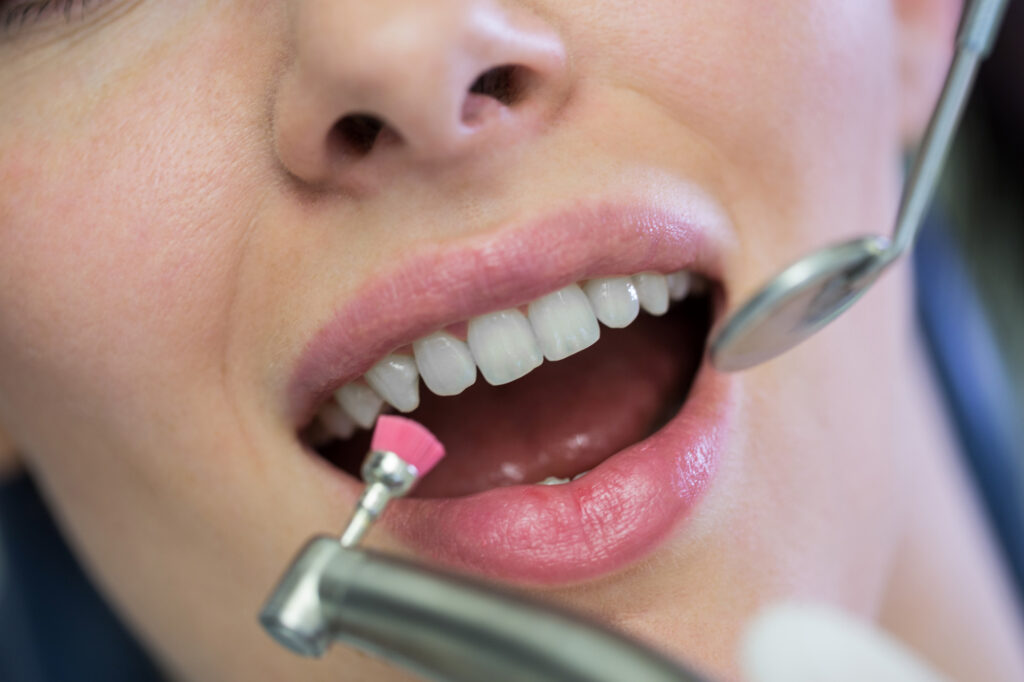 A woman’s teeth being inspected by a dental surgeon using dental tools